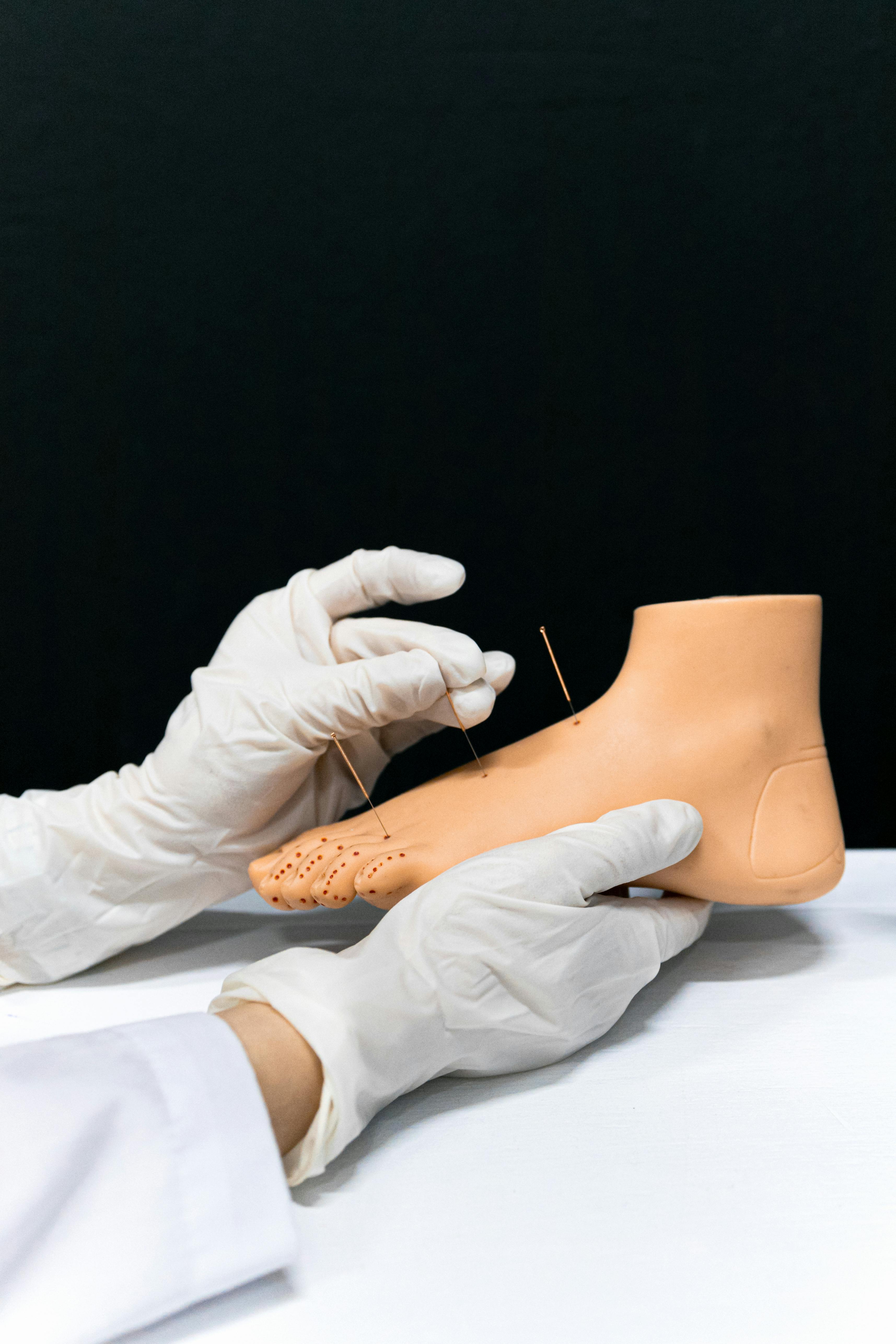 Needle Therapy